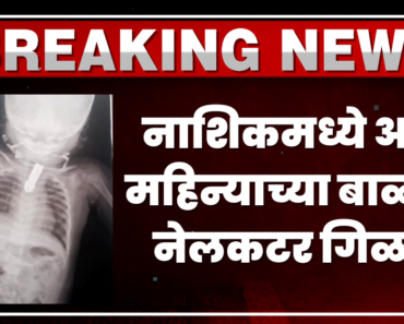 खेळता खेळता बाळानं नेलकटर गिळलं! नाशिकमध्ये डॉक्टरांनी शस्त्रक्रिया करत वाचवलं!